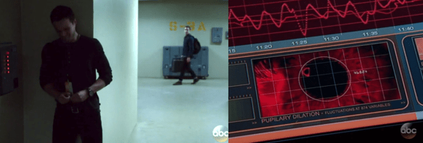 Fitz finds Ward as he is removing a splint from under his nail. 