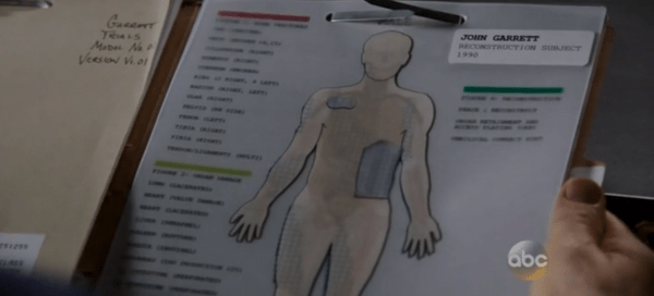 Anyone suddenly feel the urge to play Operation?