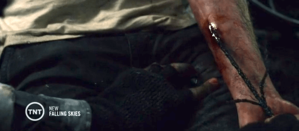 Seriously Tom, be more careful where you stick your arm. 